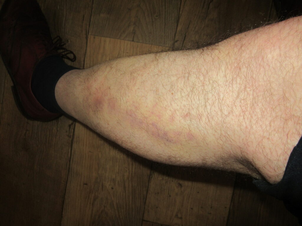 Klachten over Bram van Dijk, directeur van fitnessketen SportCity: hij reageert niet op een klacht en heeft lak aan de veiligheid van zijn klanten Klachten over Bram van Dijk, directeur van fitnessketen SportCity: hij reageert niet op een klacht en heeft lak aan de veiligheid van zijn klanten